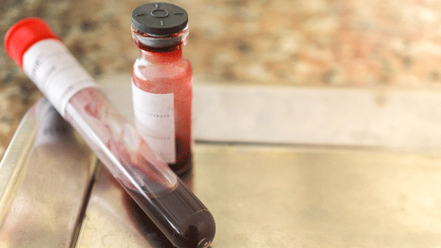 blood-process-640by360